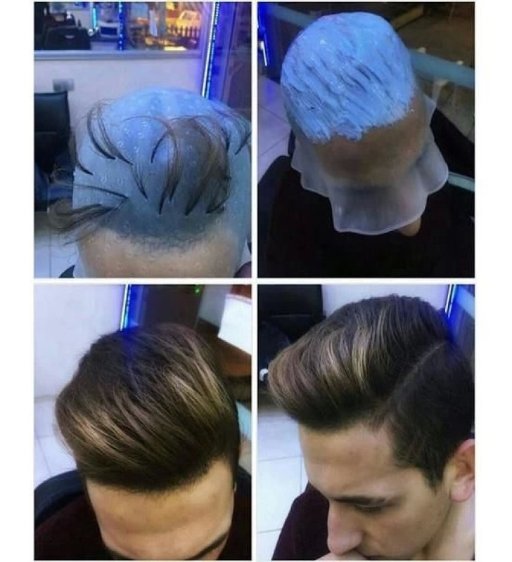 Profesyonel Silikon Delikli Röfle Bonesi ( Lisinya )